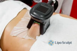 Does Fat Freezing At Home Work? 3 Fat freezing at home from Lipo Sculpt Skegness